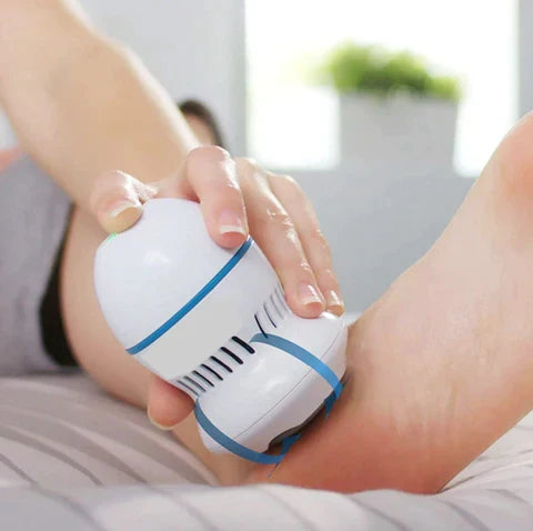 Glowora Vacuum Callus Remover